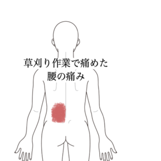 鍼灸の症例「草刈り作業で痛めた腰の痛み」（島根県出雲市）
