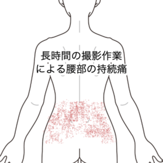 鍼灸の症例「長時間の撮影作業による腰部の持続痛」(JR品川駅/東京都品川区)