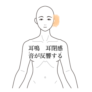 鍼灸の症例「聴力は回復したが残った耳症状への鍼治療の一例」(沖縄県那覇市)