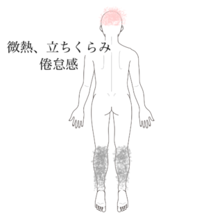 鍼灸の症例「立ち眩みと全身の倦怠感で学校生活困難」(有松駅)