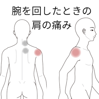 鍼灸の症例「首・肩のコリ感 うでを回した時の肩の痛み」(籠原駅/熊谷市)