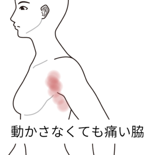 鍼灸の症例「脇から前側のつっぱる痛みと不眠」(京都市営地下鉄 烏丸御池)