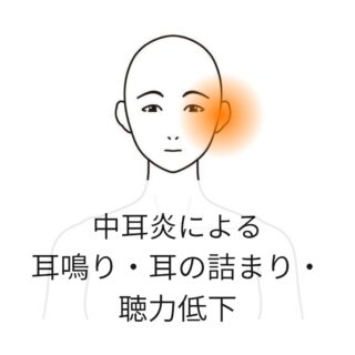 鍼灸の症例「中耳炎による耳の症状」（世田谷区　三軒茶屋駅）