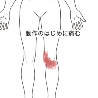 鍼灸の症例「転倒後の動作開始時に痛む左膝の痛み」（群馬県伊勢崎市）
