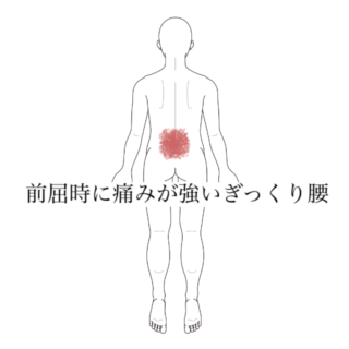 鍼灸の症例「前屈時に痛みが強いぎっくり腰」(清澄白河)
