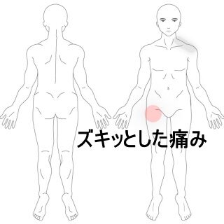 鍼灸の症例「歩行時にズキッとする股関節前側の痛み」（東室蘭駅）