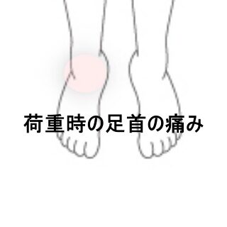 鍼灸の症例「左踵痛から右足首痛へ移行した立ち仕事後の症状」(東室蘭駅)