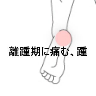 鍼灸の症例「離踵期に痛む踵の痛み」（東室蘭駅）