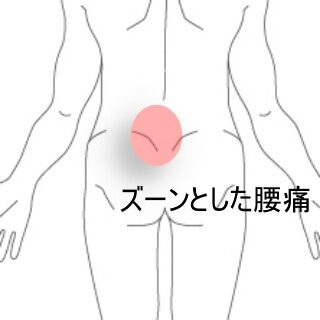 鍼灸の症例「運動後に増す腰のズーン痛」（東室蘭駅）