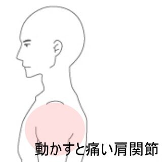 鍼灸の症例「仕事中の重量物で生じた左肩の鈍痛」（東室蘭駅）