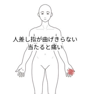 鍼灸の症例「突き指してから人指し指が握りきれない 」(阪急高槻駅/大阪府高槻市・茨木市・枚方市・京都・滋賀)
