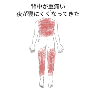 背中の痛み|背部痛、肩こり・首こりのツボ|ツボネット 鍼灸の症例が検索できるツボ辞典