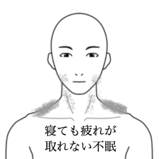 鍼灸の症例「寝ても疲れが取れない不眠の一症例」(島根県出雲市)