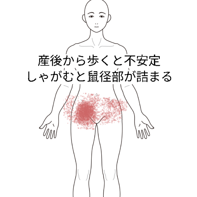 股関節痛｜鼠径部痛・恥骨痛、股関節痛のツボ｜ツボネット 鍼灸の症例