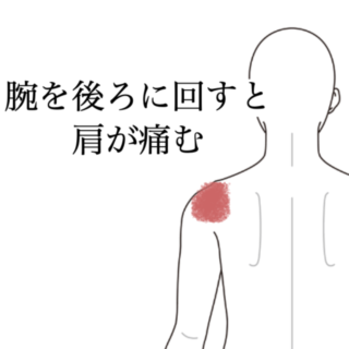 鍼灸の症例「腕を後ろに回すと肩が痛む…仕事中や寝返り時につらい左肩の不調」（島根県出雲市）