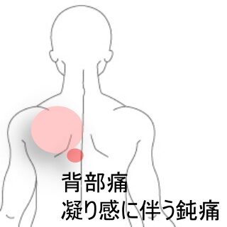鍼灸の症例「肩甲骨周辺の重だるさと鈍痛で集中力が低下」（東室蘭駅）