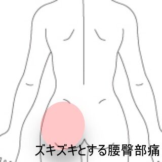 鍼灸の症例「転倒後の腰臀部のズキズキ痛で歩行困難」（東室蘭駅）