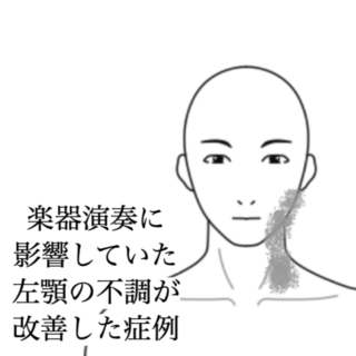 鍼灸の症例「楽器演奏に影響していた左顎の不調が改善した症例」（島根県出雲市）