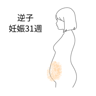鍼灸の症例「妊娠31週の逆子」（勝田駅）