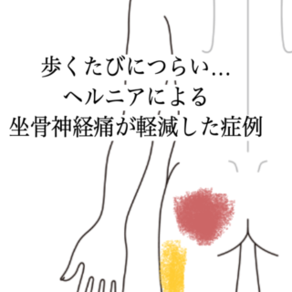 鍼灸の症例「歩くたびに響くお尻〜脚の痛み。ヘルニアによる坐骨神経痛が軽減した症例」（島根県出雲市）