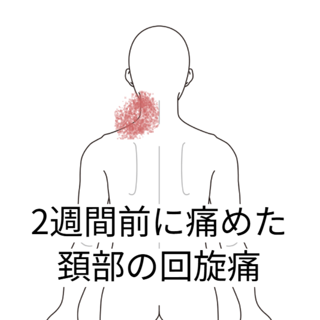 ライブで痛めた首の痛み｜寝違え（首の痛み）のツボ｜ツボネット 鍼灸