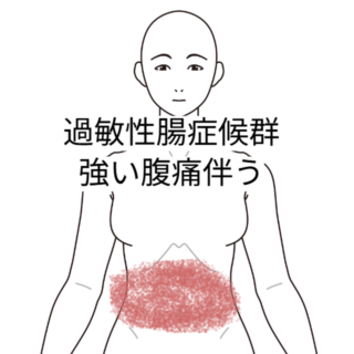 鍼灸の症例「過敏性腸症候群　強い腹痛を伴う」（勝田駅）