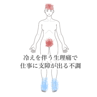 鍼灸の症例「冷えを伴う生理痛で仕事に支障が出る不調」（清澄白河）