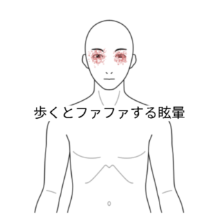 鍼灸の症例「歩くとファファする眩暈」(阪急高槻駅/大阪府高槻市・茨木市・枚方市・京都・滋賀)