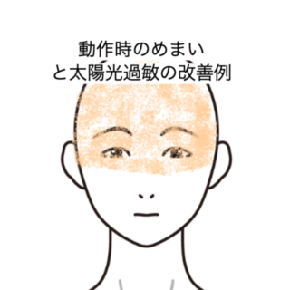 鍼灸の症例「動作時のめまいと太陽光過敏の改善例」（JR品川駅／東京都品川区）