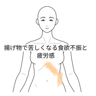 鍼灸の症例「「揚げ物等で苦しくなる食欲不振と疲労感」」(名古屋市営地下鉄 東山線 池下駅/名古屋市千種区)