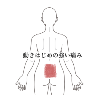 鍼灸の症例「急性腰痛の経過報告」（沖縄県那覇市）