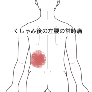鍼灸の症例「くしゃみ後の左腰の常時痛」（JR品川駅／東京都品川区）