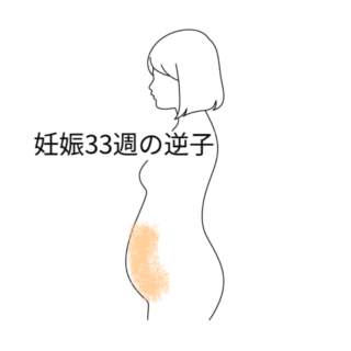 鍼灸の症例「妊娠33週の逆子」（愛知県あま市 / 名鉄七宝駅）