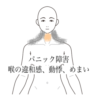 鍼灸の症例「横になると悪化する喉の息苦しさとふわふわするめまい」（有松駅）
