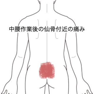 鍼灸の症例「中腰作業後の仙骨付近の痛み」（JR品川駅／東京都品川区）