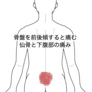 鍼灸の症例「骨盤を前後傾すると痛む仙骨と下腹部の痛み」（JR品川駅／東京都品川区）