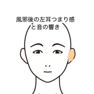 鍼灸の症例「風邪後の左耳つまり感と音の響き」（JR品川駅／東京都品川区）