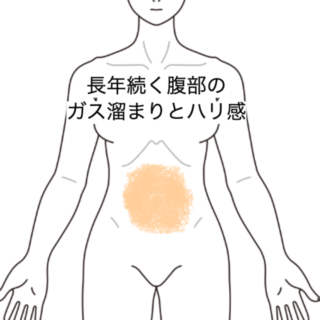 鍼灸の症例「長年続く腹部のガス溜まりとハリ感」（JR品川駅／東京都品川区）