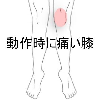鍼灸の症例「しゃがむと痛い左膝痛と階段降下時の痛み」（東室蘭駅）