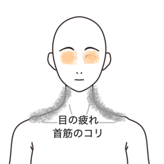 鍼灸の症例「首から腰にかけての張りと腰を捻ると痛む症状」（群馬県伊勢崎市）