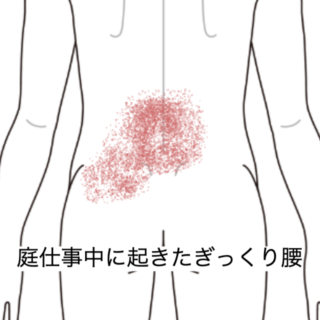 鍼灸の症例「庭仕事中に発症した下部腰椎のズキズキ痛と歩行困難」（群馬県伊勢崎市）