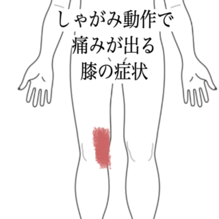 鍼灸の症例「しゃがみ動作で痛みが出る膝の症状に対する施術例」（島根県出雲市）