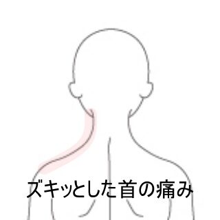 鍼灸の症例「首を動かすとズキッと痛む、デスクワーク姿勢による左後頚部痛　」（東室蘭駅）