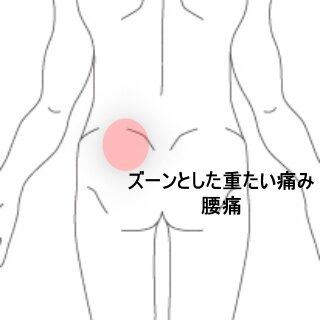 鍼灸の症例「ぎっくり腰後2週間経過しても残る左腰部から臀部のズーンとした鈍痛」（東室蘭駅）