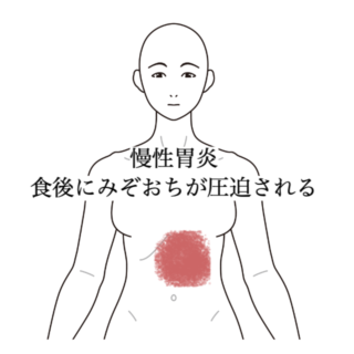 鍼灸の症例「慢性胃炎　3ヶ月の経過報告」（沖縄県那覇市）