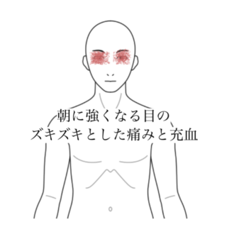 鍼灸の症例「朝に強くなる目のズキズキとした痛みと充血」（清澄白河）