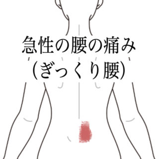 鍼灸の症例「急性の腰の痛み（ぎっくり腰）に対する施術例」（島根県出雲市）