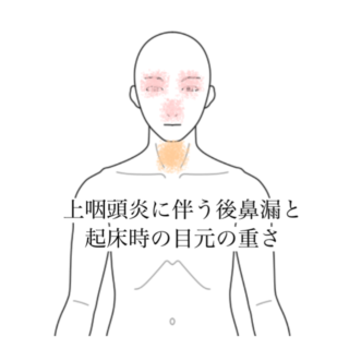 鍼灸の症例「上咽頭炎に伴う後鼻漏と起床時の目元の重さ」（清澄白河）