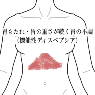 鍼灸の症例「胃もたれ・胃の重さが続く胃の不調（機能性ディスペプシア）」（島根県出雲市）