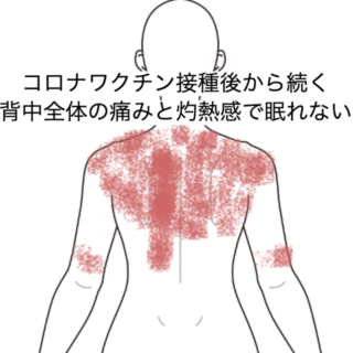 鍼灸の症例「コロナワクチン接種後から続く背中全体の痛みと灼熱感で眠れない」（JR品川駅／東京都品川区）